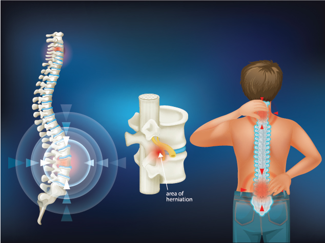  All You Should Know About Spinal Cord Injury